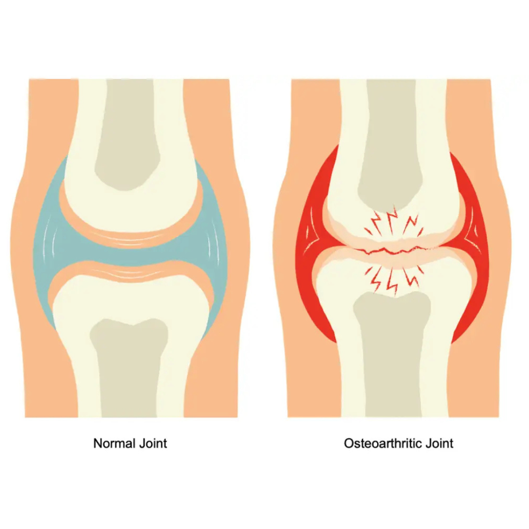What is Arthritis – CVS Online Vet, Pet & Farm Supplies